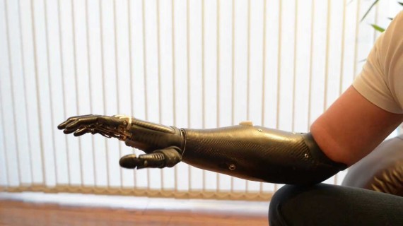 ‘Terminator’ arm is world’s most advanced prosthetic limb